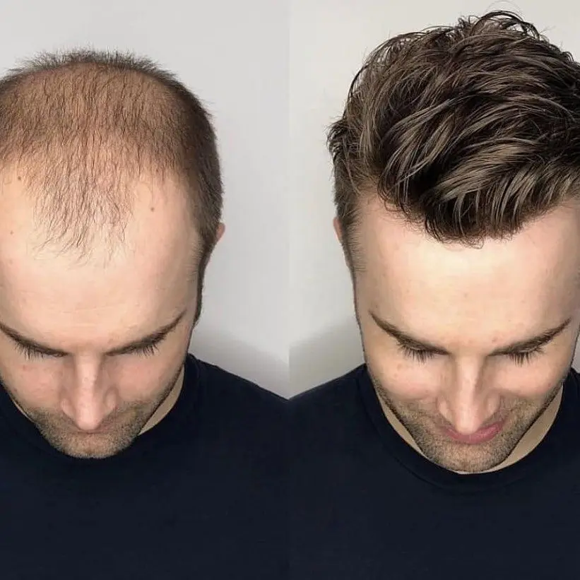 Transformación
